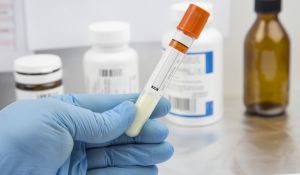 Lab test