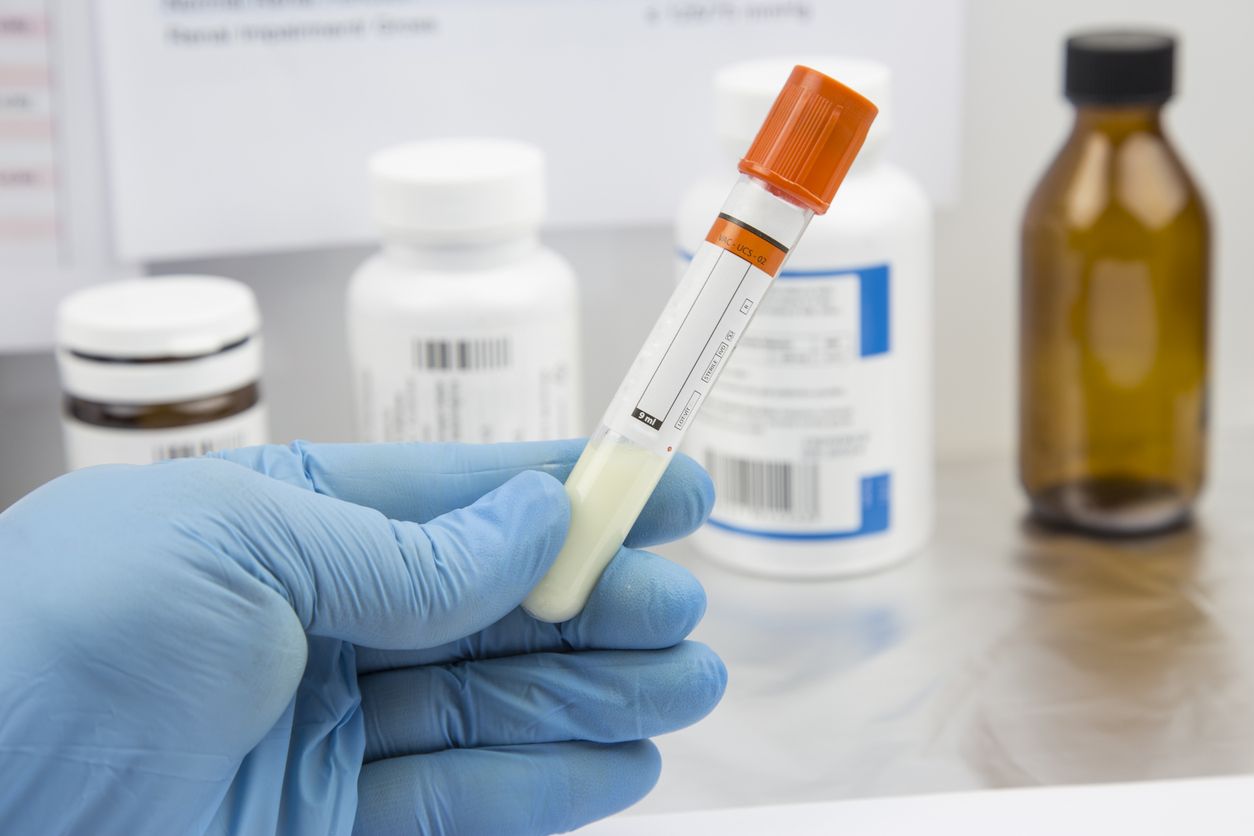 Lab test